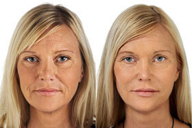 Photo 2 before and after using Goji Cream