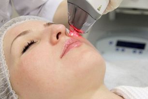 The process of rejuvenating the facial skin with a fractionated laser