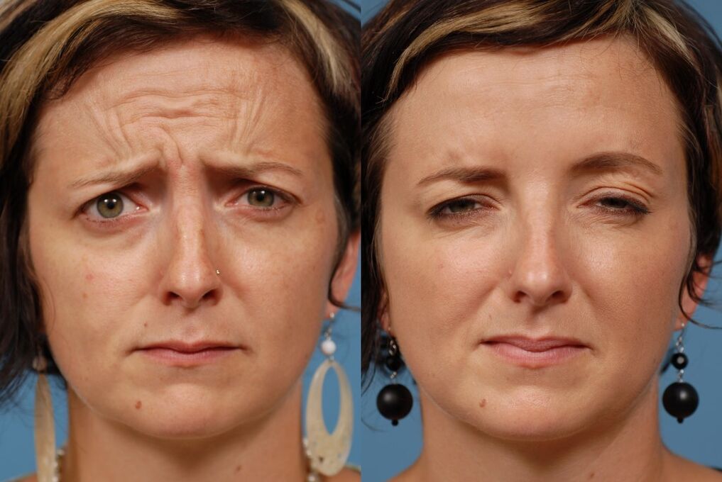 before and after using the massaging rejuvenator ltza photo 2