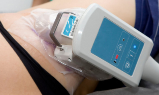 cryolipolysis on the skin of the body